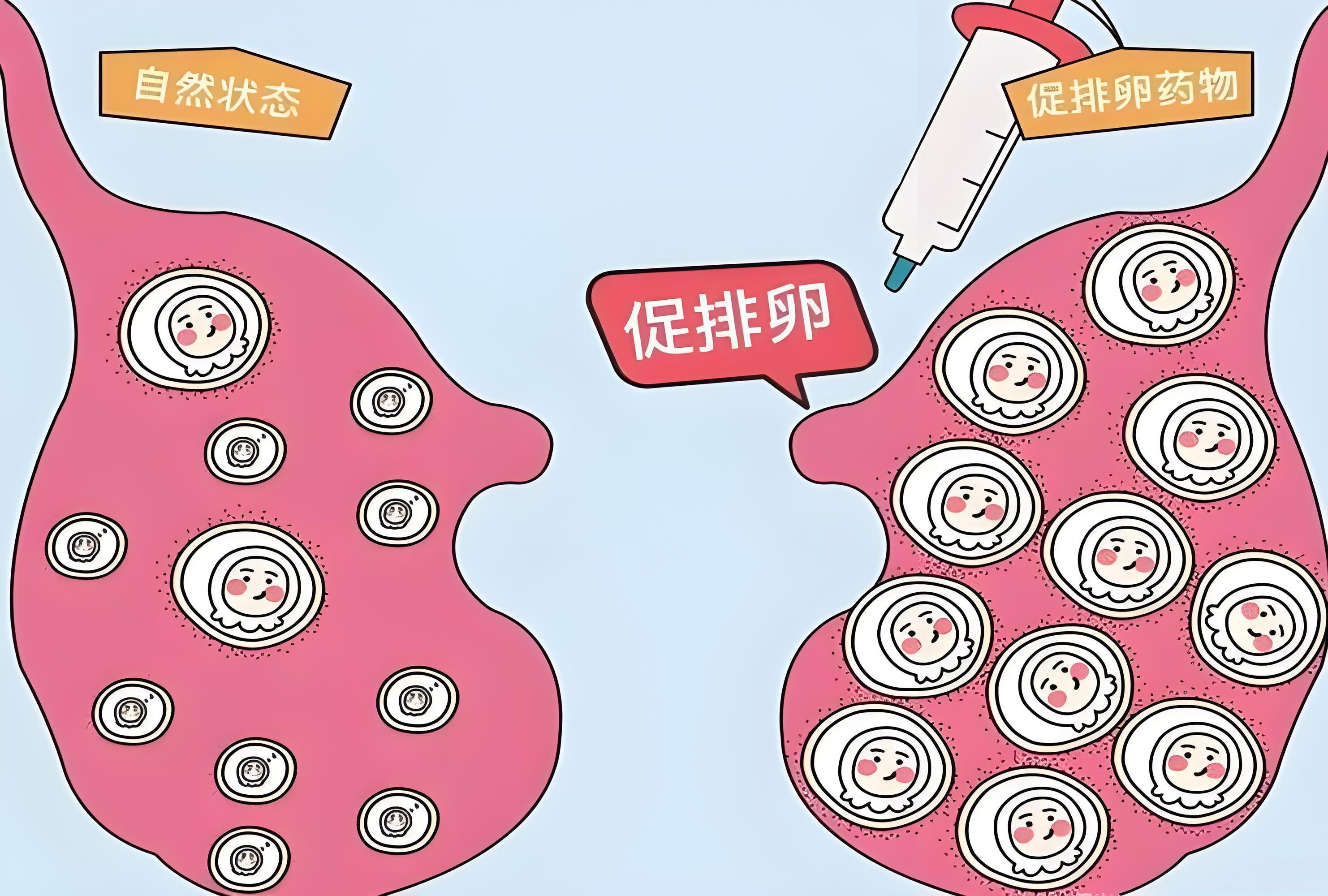 促排卵周期分阶段管理